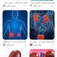فروش. کلیه   سن 16سال